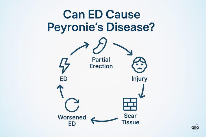 Peyronie’s Disease and Erectile Dysfunction: Link and Effects on Sexual Health 4 infographic explaining how erectile dysfunction can contribute to Peyronie’s disease through a cycle — partial erection, injury, scar tissue formation, and worsening ED.