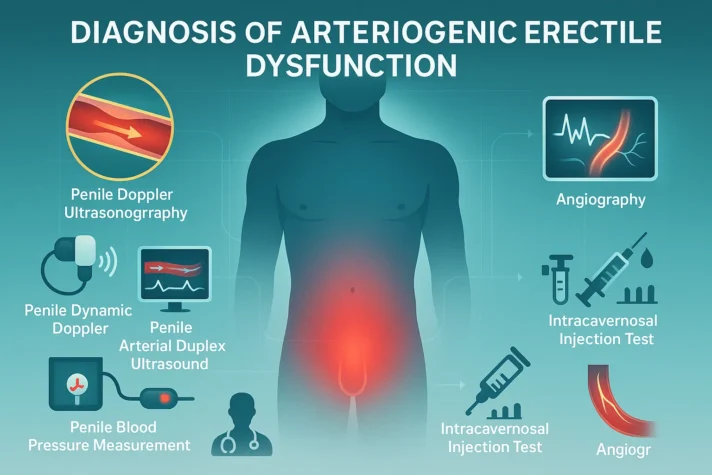Medical infographic titled ‘Diagnosis of Arteriogenic Erectile Dysfunction.’ A male silhouette with glowing pelvic area is shown surrounded by diagnostic methods: penile Doppler ultrasonography, penile dynamic Doppler, penile arterial duplex ultrasound, penile blood pressure measurement, angiography, and intracavernosal injection test. Icons illustrate each diagnostic tool with artery and syringe visuals.