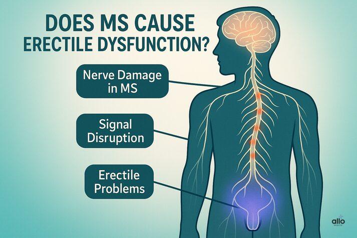 Medical illustration showing the link between multiple sclerosis and erectile dysfunction, highlighting nerve damage, disrupted signals, and erection problems in the male body.