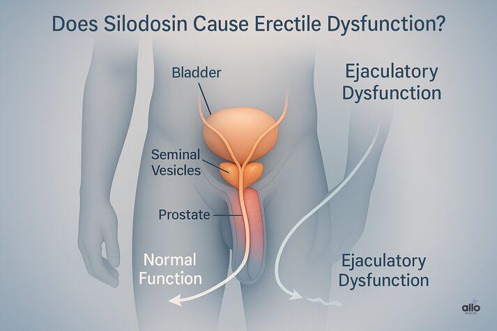 Silodosin and Erectile Dysfunction: How Silodosin Affects Sexual Performance 2 “Medical diagram of male pelvic anatomy showing prostate, bladder, and seminal vesicles, illustrating that Silodosin mainly causes ejaculatory dysfunction, not erectile dysfunction.”