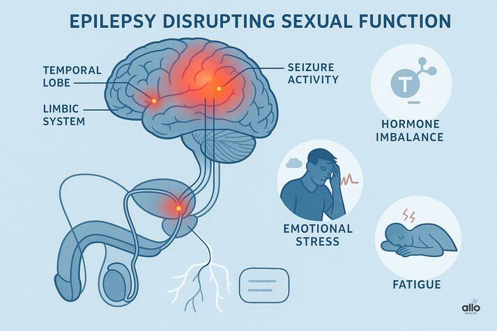 “Infographic showing how epilepsy disrupts sexual function by affecting the temporal lobe and limbic system, leading to hormone imbalance, emotional stress, and fatigue.”